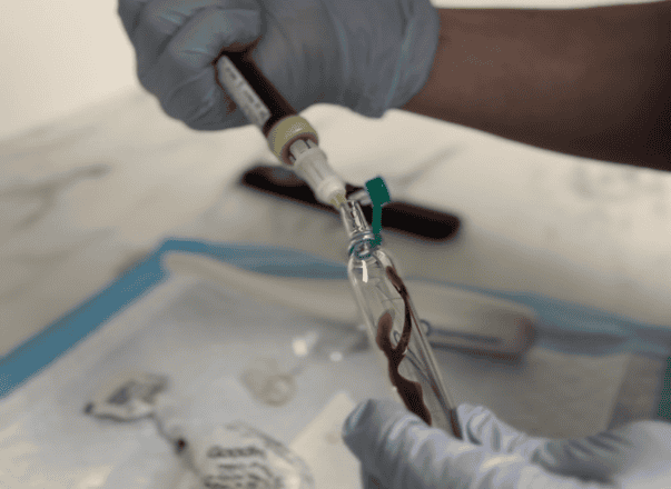 Gloved hands drawing blood into a vial. Medical professional performing a blood draw for lab analysis. Blood sample collection for diagnostic testing.