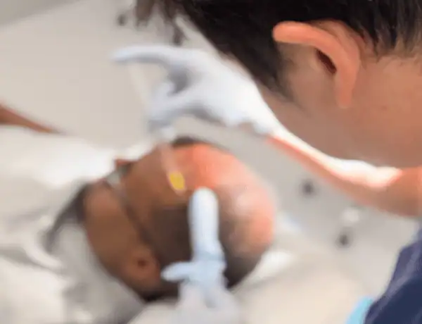 prp hair treatment in Perth done by expert at FUE Clinics